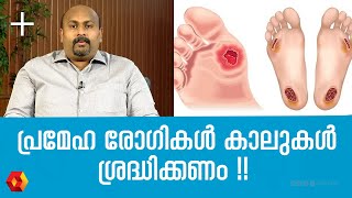 പ്രമേഹരോഗികളുടെ കാലിൽ മുറിവുകൾ ഉണ്ടാകും | DIABETES | LEG ULCERS | Diabetes-Related Foot Conditions