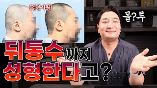 하다하다 뒤통수 성형까지? 근데 위험 한 것 아님??