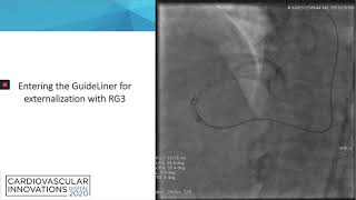 Karacsonyi_Use of Retrograde Dual Lumen Catheter in Percutaneous Coronary_Coronary v2