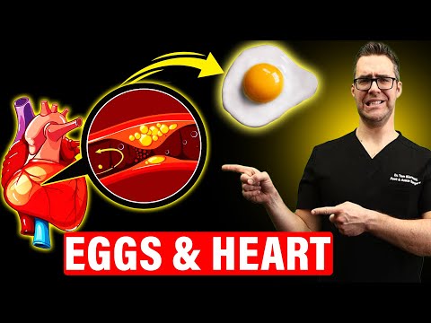 The SHOCKING Truth About Daily Egg Consumption [Heart and Arterial Disease]