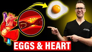 The SHOCKING Truth About Eating Eggs Daily [Heart & Artery Disease]
