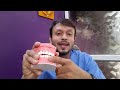 नीचे जा रहे मसूड़ो का घरेलू इलाज best home remedies for gum recession hindi