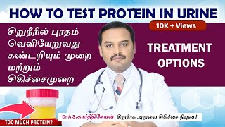 சிறுநீரில் புரதம் வெளியேறுவது கண்டறியும் முறை  | Proteinuria diagnosis / Proteinuria treatment