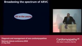 Broadening the spectrum of arrhythmogenic right ventricular cardiomyopathy (ARVC)