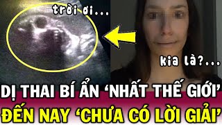 Mang thai QUÁI VẬT, cô gái C.HẾT THẢM vì bị cắn_nát nội tạng khiến CĐM kinh hãi | Tin Việt Độc Lạ