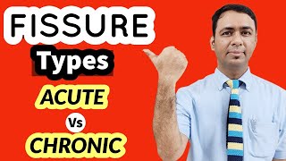 ACUTE FISSURE VS CHRONIC FISSURE ( WHAT IS MAIN DIFFERENCE IN TREATMENT OPTIONS )