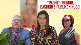 LIVE ME ODETEN-La burrin, u martua me plakun italian/60-vjeçarja:Dashurova një të tretë,gjeta belanë