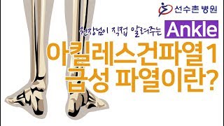 아킬레스건파열1 - 급성 아킬레스건파열