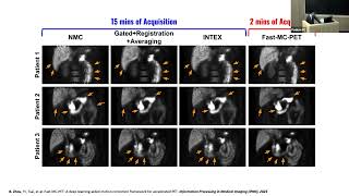 Deep Learning Guided Reconstruction and Processing for PET, SPECT, and CT