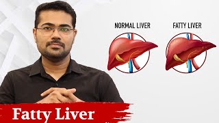 Know About Fatty Liver   Dr Manoj Johnson