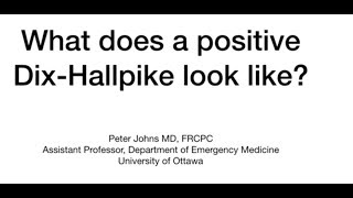 What does a positive Dix-Hallpike look like?