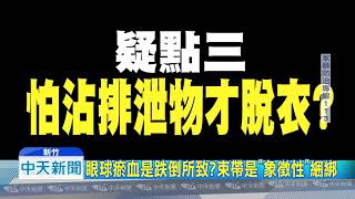 20180924中天新聞　罰站摔倒竟「眼球瘀血」？　虐兒狠父疑避重就輕