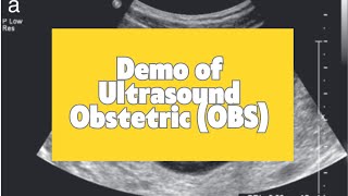 Demo of Ultrasound Obstetric (OBS) | Dr. Mehmood Iqbal | C Health Academy