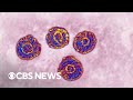 Inside look at new White House initiative to eliminate hepatitis C