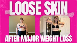 All My LOOSE SKIN After VSG Weight Loss | 120lbs Weight Loss Surgery Journey Loose Excess Skin