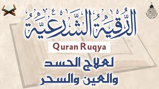 أقوى رقية شرعية شاملة مكتوبة لعلاج السحر والمس والحسد والعين الحاقدة في الرزق والبيت والأولاد