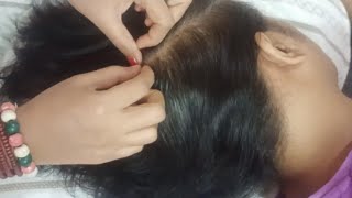 Scalp ASMR - The Ultimate Relaxation Experience