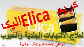 كريم اليكا ام Elica M  لعلاج الالتهابات الجلدية دواعى الاستعمال والاثار الجانبية