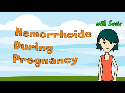 Hemorrhoids During Pregnancy Hemorrhoids During Pregnancy