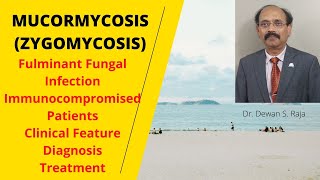 Mucormycosis (Zygomycosis)