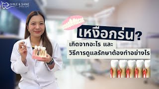 เหงือกร่น รักษาได้ไหม เกิดจากอะไร รักษาอย่างไร | Smile and Shine Dental Clinic