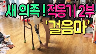 [의족로봇맨] 새 의족 적응기 2부/ 43살에 걸음마 / 의족 걷기 Prosthetic Leg artificial leg