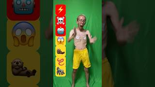 【TikTok100万再生】39kgのガリガリが踊るダンス／39kg boney  dancing dance#dance#ダンス #shorts