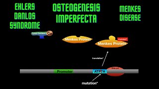 USMLE Step 1 - Lesson 23 - Osteogenesis Imperfecta, Ehlers Danlos Syndrome and Menkes disease