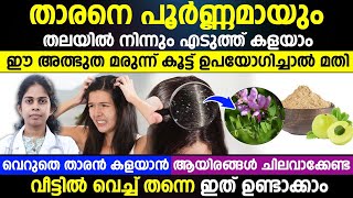 താരനെ തലയിൽ നിന്ന് പൂർണമായും മാറ്റാം | ഈ മരുന്ന് കൂട്ട് ഉപയോഗിച്ചാൽ മതി | THARAN POKAN TIP