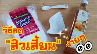 กำจัดสิวเสี้ยนตรงจมูก รูขุมขนเนียน กระชับ ตั้งแต่ครั้งแรก|PommeVarintorn