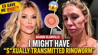 Brandi Glanville’s Shocking Health Scare|Adult Film Star Ex Give Her S*XUALLY TRANSMITTED Ringworm?