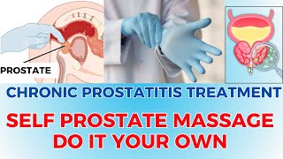 SELF PROSTATE MASSAGE: DO IT YOUR OWN... #prostatitis #prostatemassage