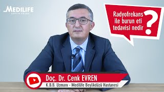 Radyofrekans ile Konka (burun eti) tedavisi - Doç. Dr. Cenk EVREN