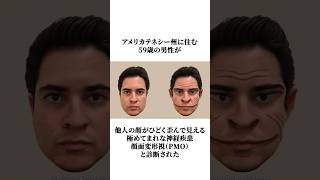 【顔面変形視】人の顔がひどく歪んで見える？