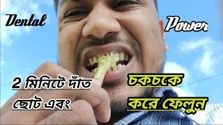 আজকে সকালথেকে সন্ধ্যা কিকিঘটল সম্পূর্ণআছে vlogvideo দাঁতকে শক্তিশালী ও মজবুত করেরাখার সহজ পদ্ধতি।