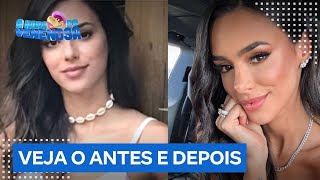 Bruna Biancardi abre o jogo sobre plásticas; veja antes e depois