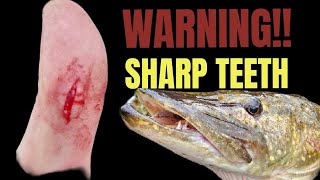 WARNING! SHARP TEETH!! My first Pike Injury !