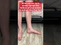 one move to actively correct flat feet