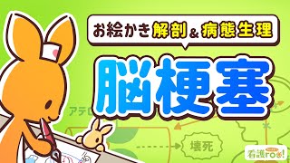 【脳神経系】脳梗塞｜お絵かき解剖＆病態生理