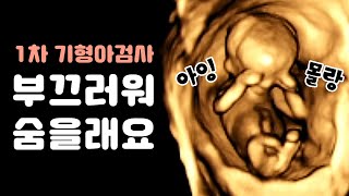 부끄러워서 얼굴 가리는 초음파 속 아기🙈│1차 기형아검사 하던 날 Vlog