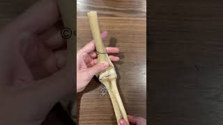 Radius Dislocation