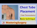 Chest Tube placement (Tube Thoracostomy) - Technique