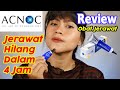 Review ACNOC Acne Spot Gel OBAT JERAWAT | Risa Florendo