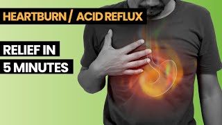 Reduce Your Heart Burn / GERD In 5 Mins | Acid Reflux Treatment