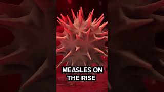 At least 48 reported cases of measles across several West Texas counties