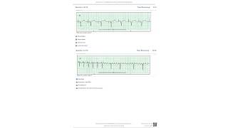 Relias Dysrhythmia Basic Test Answers 2023 Dysrhythmia – Basic A  A+ GRADE 100% VERIFIED