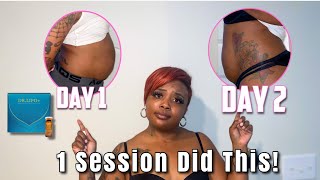 1 Session of Dr. Lipo gave me AMAZING Results|Liquid Lipo|Dr Lipo