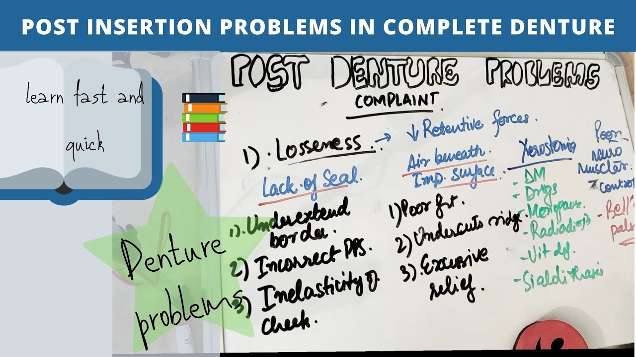 Post Insertion Problems In Complete Denture (Part-1) - YouTube