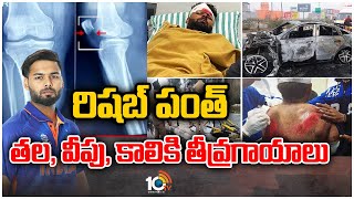 రిషబ్‌ పంత్‌ తల, వీపు, కాలికి తీవ్రగాయాలు | Cricketer Rishabh Pant Health Updates | 10tv