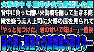 【感動する話】火事の中6歳の少女を救出した際背中に負った醜い火傷痕を隠して生きる俺。俺を嫌う美人上司に火傷の痕を見られて「やっと見つけた。君のせいで妹は」→目の前に黒塗りの高級車が停まり…